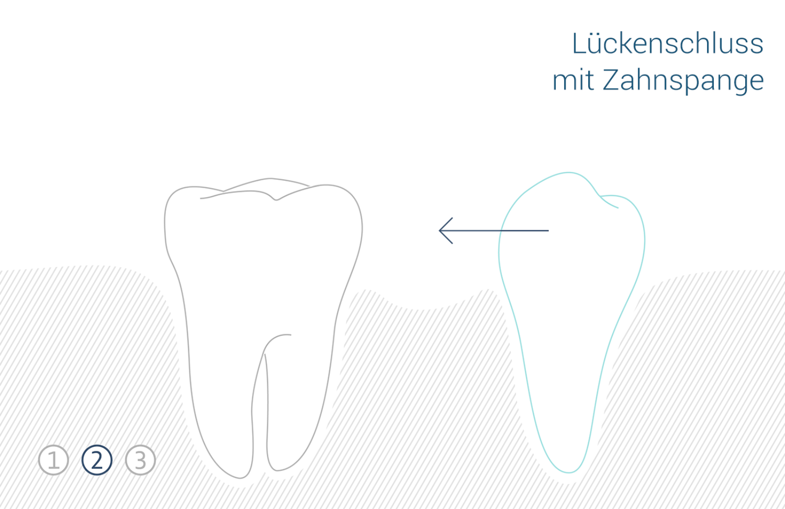 Zahnmedizin lueckenschluss 1 2