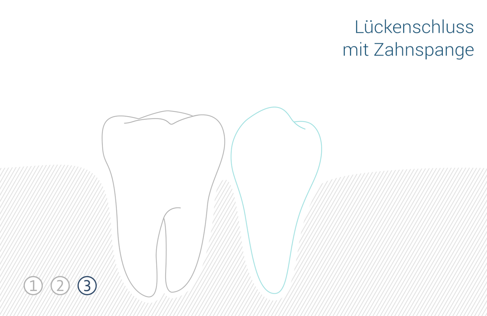 Zahnmedizin lueckenschluss 1 3